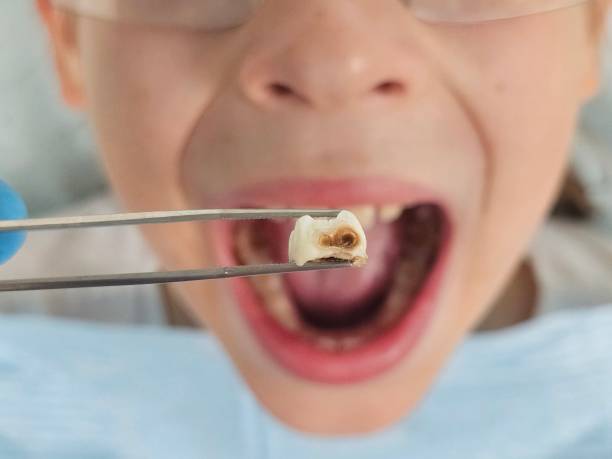 Best Emergency Broken Tooth Repair in Ridgeland, SC