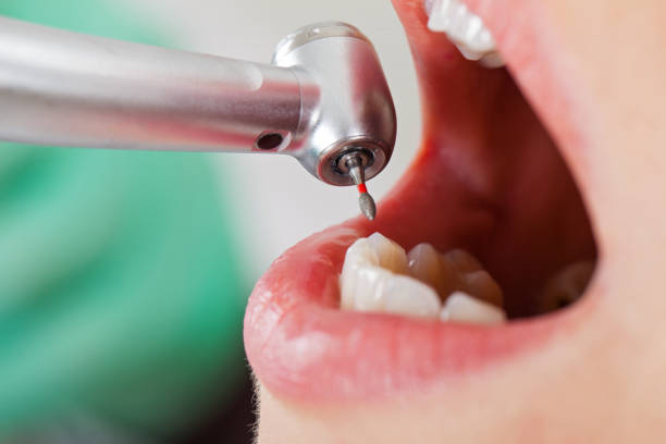 Best Emergency Dental Care for Trauma or Injury in Ridgeland, SC